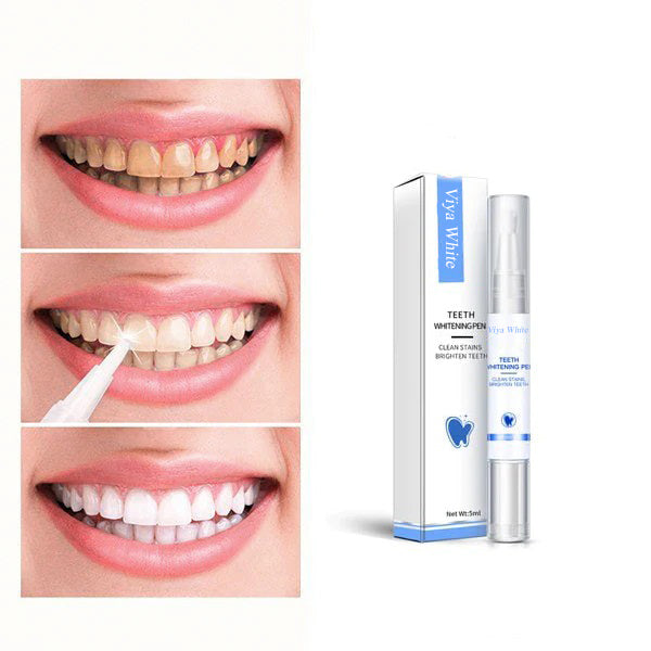 PearlWhite – Snelle Tandbleking Voor Een Stralende Glimlach 
